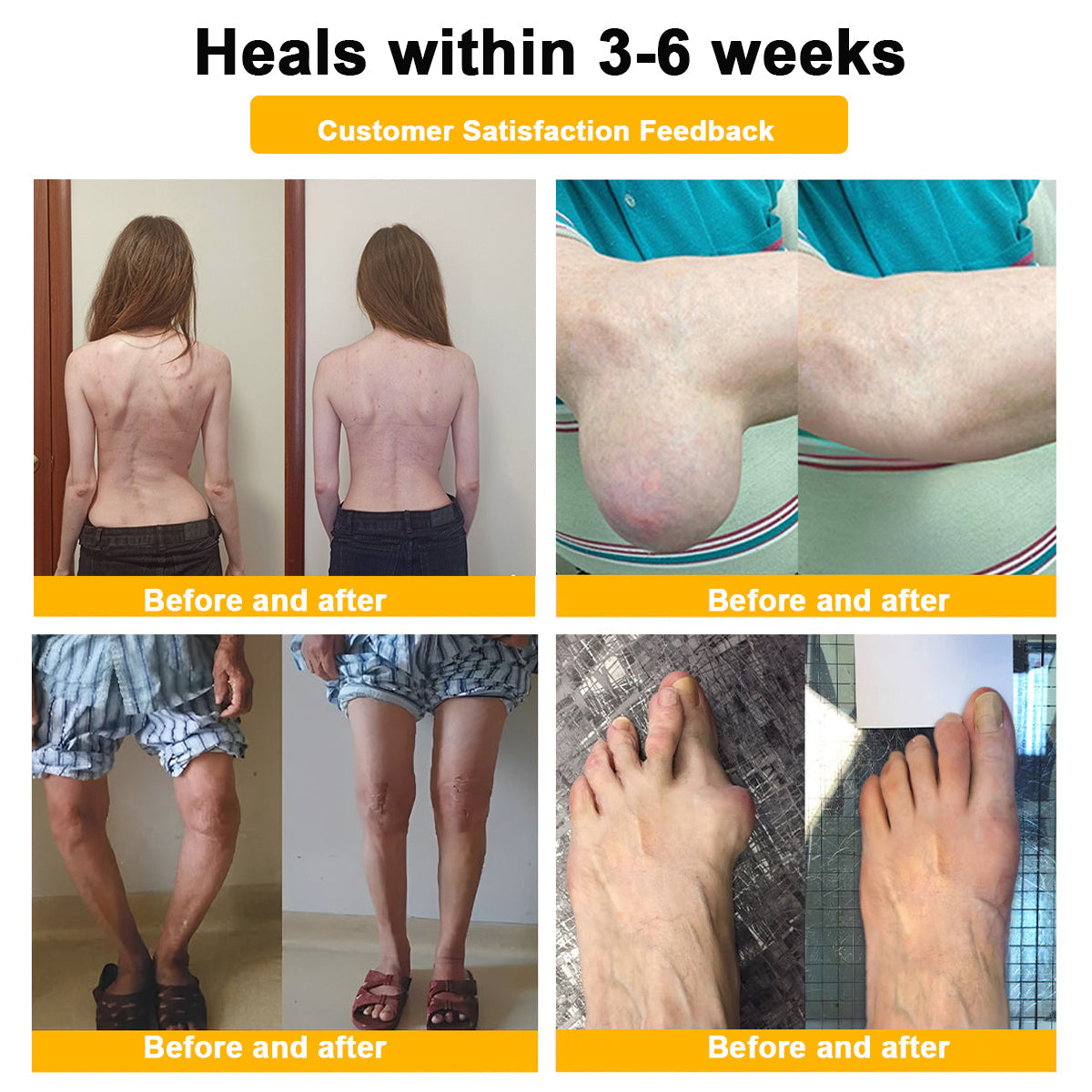 LOVILDS™ Botulinum Toxin & Bee Poison Pain-Relief Bone Healing Cream