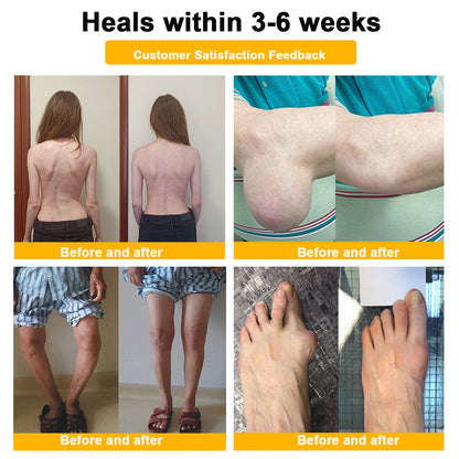 LOVILDS™ Botulinum Toxin & Bee Poison Pain-Relief Bone Healing Cream