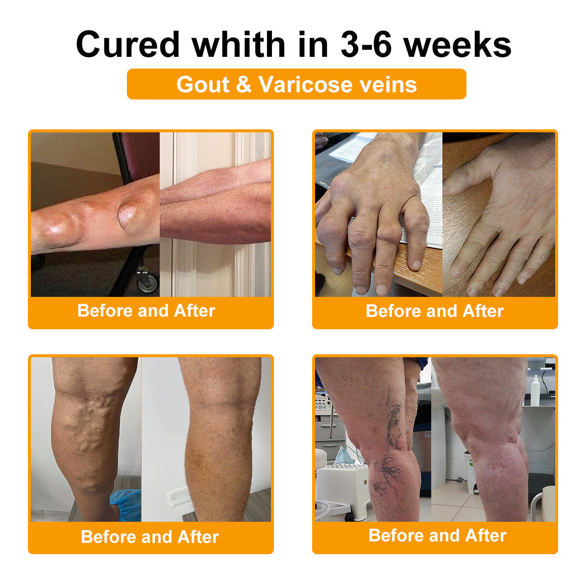 LOVILDS™ Botulinum Toxin & Bee Poison Pain-Relief Bone Healing Cream