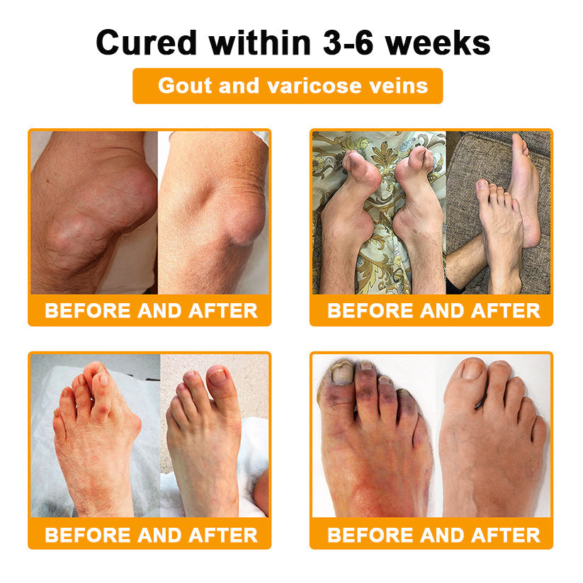 LOVILDS™ Botulinum Toxin & Bee Poison Pain-Relief Bone Healing Cream