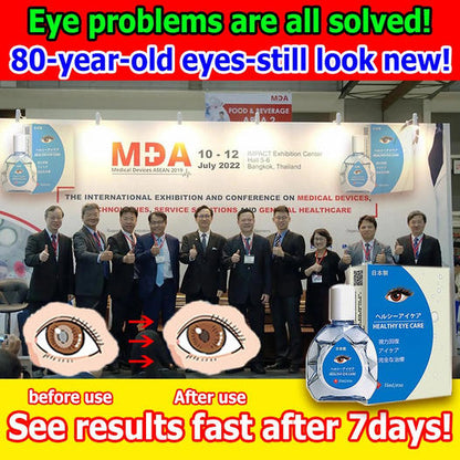 Japan Vision Drops — Rapidly Heals All Eye Conditions & Restores Vision