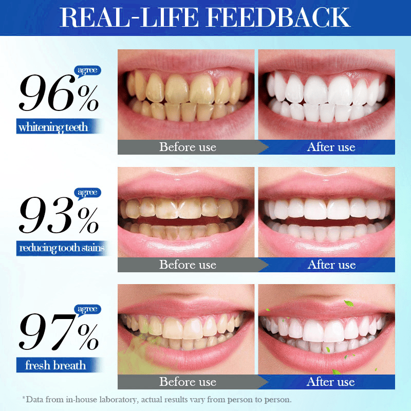 💥Hot Listing 🔥LOVILDS® Hydroxyapatite Toothpaste 7.5% for Enamel Repair & Teeth Whitening Refreshing Flavor Fluorid