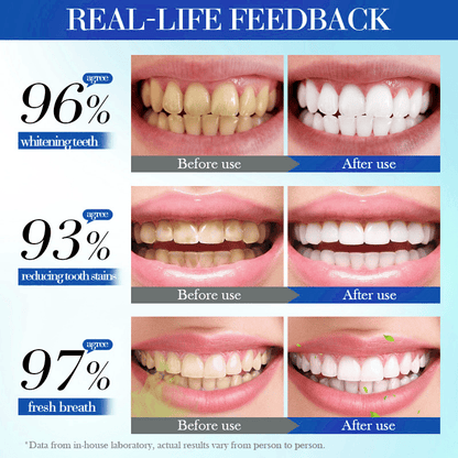 💥Hot Listing 🔥LOVILDS® Hydroxyapatite Toothpaste 7.5% for Enamel Repair & Teeth Whitening Refreshing Flavor Fluorid